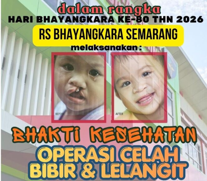
					Sambut Hari Bhayangkara ke-80, Polda Jateng Hadirkan Operasi Celah Bibir dan Lelangit Gratis